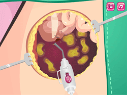Beauty Ella Appendix Surgery - Management & Simulation - POG.COM
